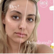 Is Your Skin Dry or Dehydrated?